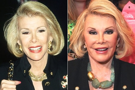 A picture of two different face types of Joan Rivers.